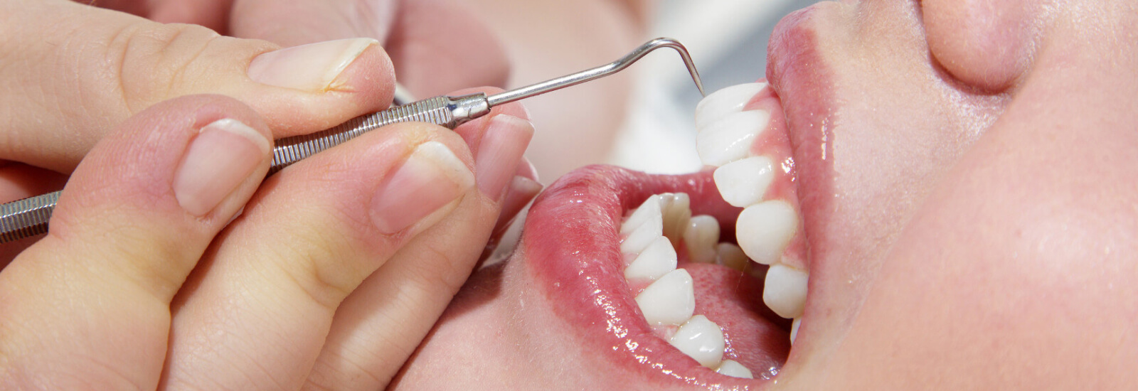 10 Solid Reasons To Avoid cost of smile transformation